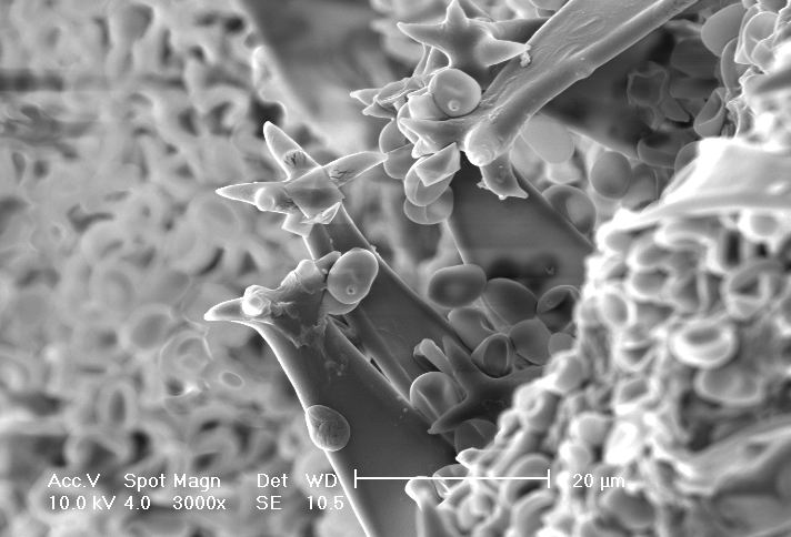 provo anch''io con la microscopia ......elettronica