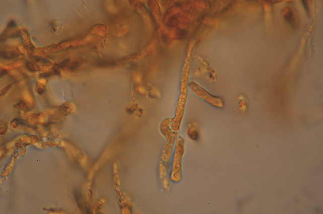 Una rara polyporacea: Parmastomyces mollissimus