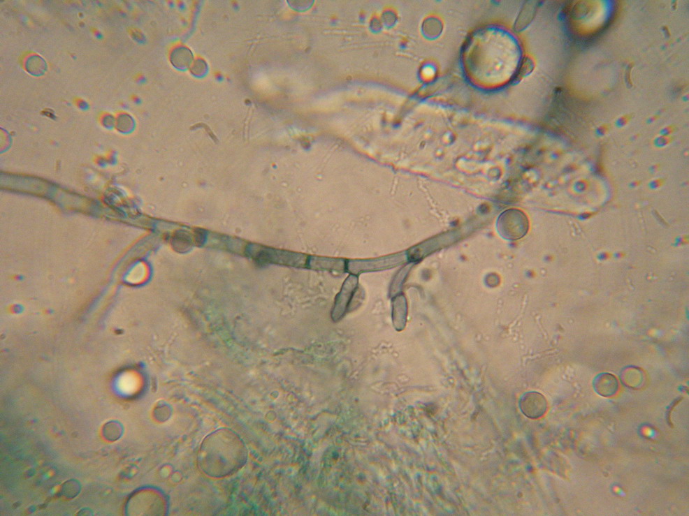 Microscopia e........MICRO funghi (muffe)