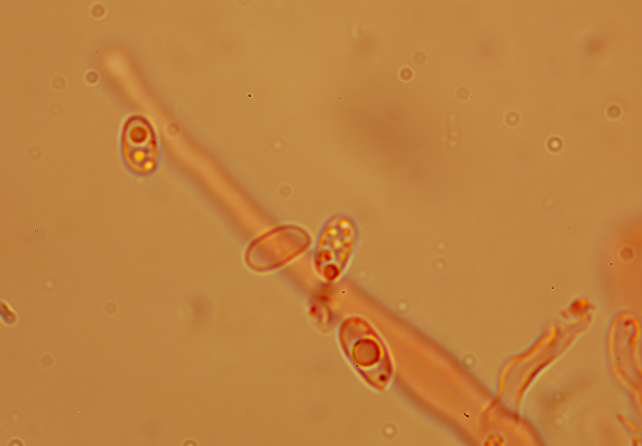 Phlebia subochracea