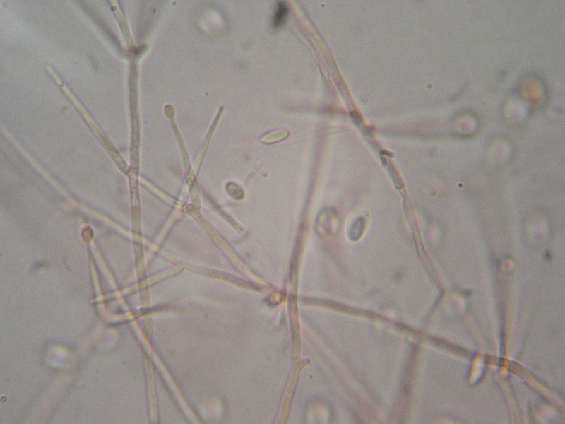 Da determinare (Tubaria romagnesiana parassitata)