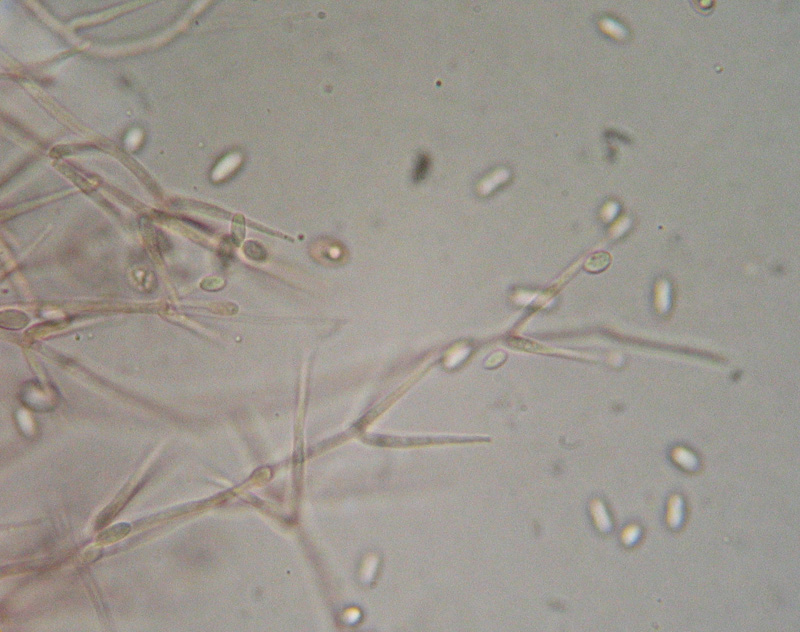 Da determinare (Tubaria romagnesiana parassitata)