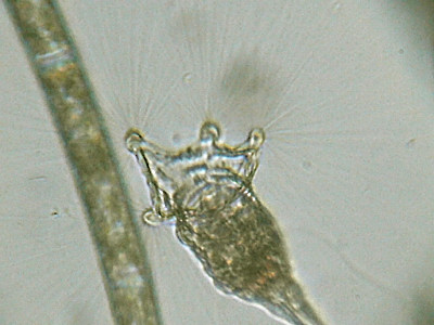 Altri microinvertebrati