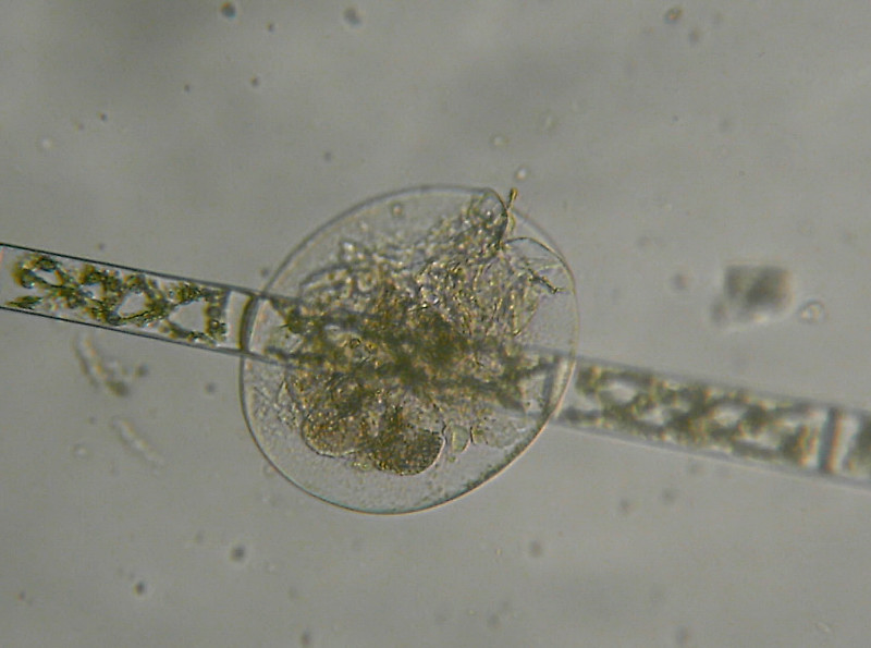 Altri microinvertebrati