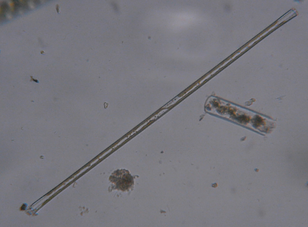 Microscopia delle acque astatiche del Bosco di Foglino