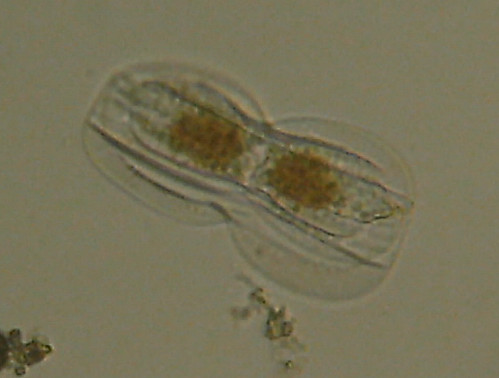 Microscopia delle acqua di Torre Flavia