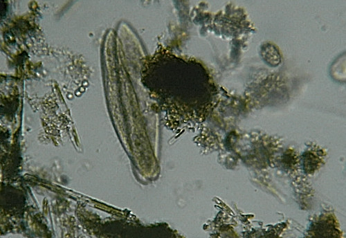 Microscopia delle acque sulfuree di Canale Monterano