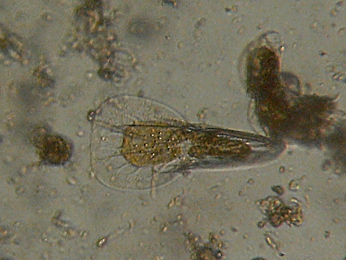 Microscopia delle acqua di Torre Flavia