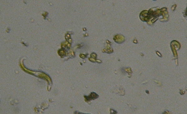 Microscopia delle acque sulfuree di Canale Monterano