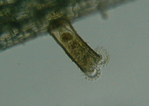 Microscopia delle acqua di Torre Flavia