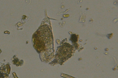 Microscopia delle acque sulfuree di Canale Monterano