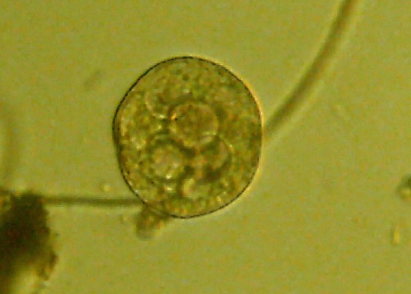 Microscopia delle acque del Fosso del Norcino (Cerveteri)