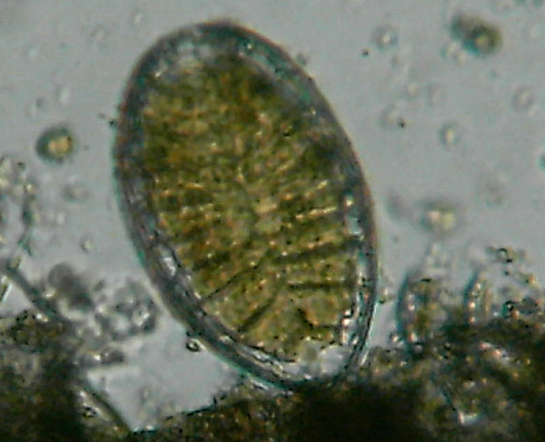 Microscopia delle acqua di Torre Flavia