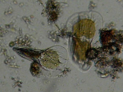 Microscopia delle acqua di Torre Flavia